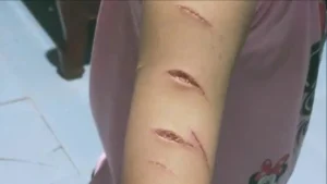 Công an thông tin vụ nữ sinh lớp 5 ở Cà Mau bị rạch tay