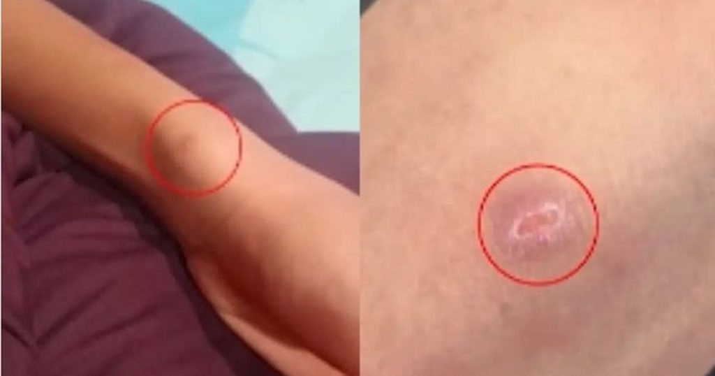 Thấy con trai người đầy vết thương, bố mẹ chết lặng khi nghe em kể chuyện đau lòng xảy ra suốt 2 năm ở trường
