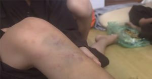 Vụ bạo hành trẻ tại chùa Bầu, Phú Thọ: Nhiều cháu có thương tích