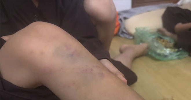 Vụ bạo hành trẻ tại chùa Bầu, Phú Thọ: Nhiều cháu có thương tích